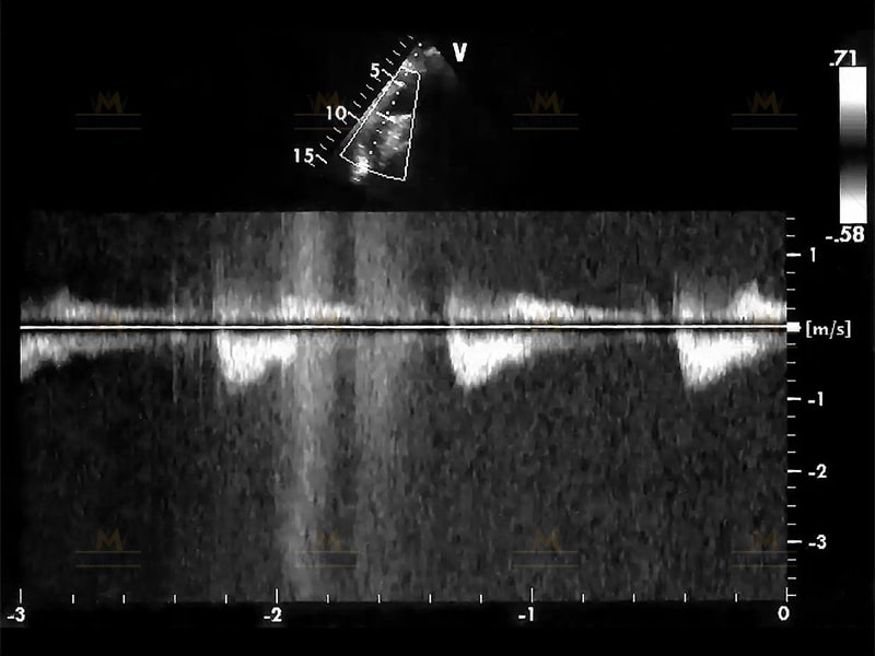 Radiographic Testing of Steel Structures
